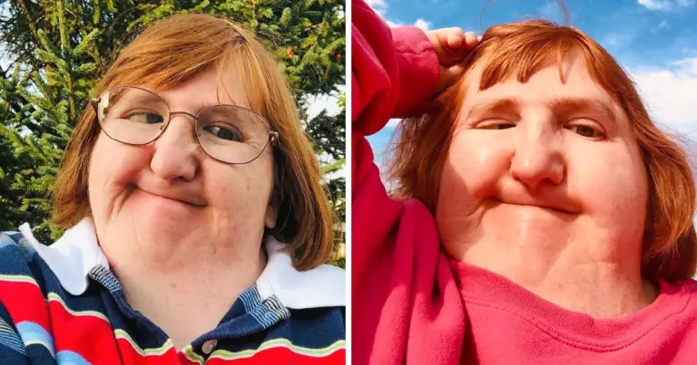 A Woman Posts Selfies for a Year to Defy Her Bullies and Ends Up Modeling
